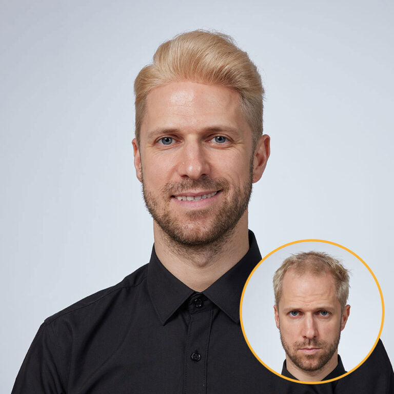 Men’s Thin Skin Hair System – Natural Human Hair Toupee HS1
