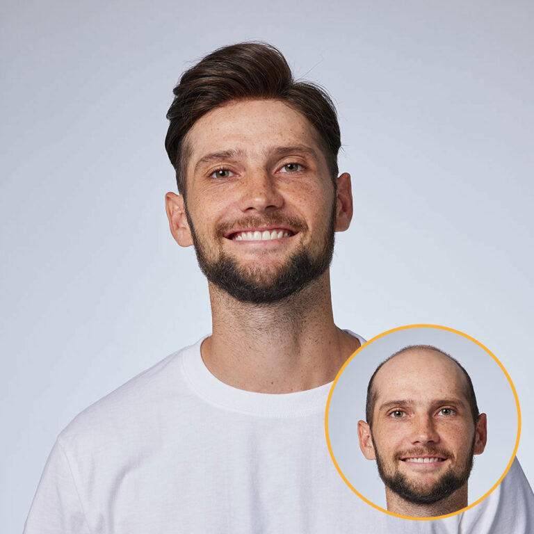 Men's Thin Skin Hair System - Invisible V -Loop Human Hair Toupee HS1V