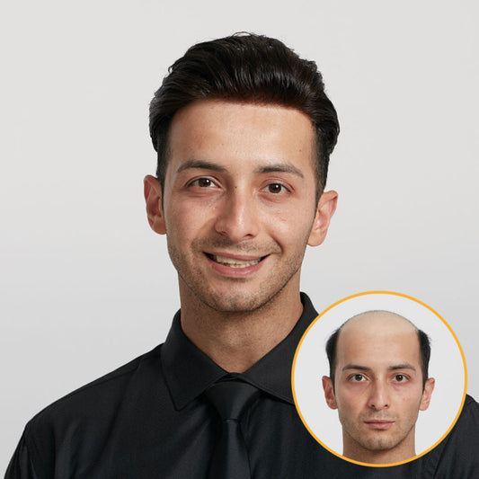 Men’s Ultra Thin Skin Hair System – Invisible V-Loop Toupee HS25-V