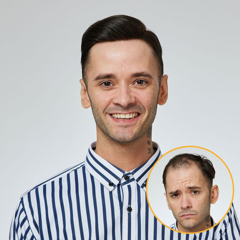 Men’s Lace Hair System – Natural Human Hair Toupee New Australia