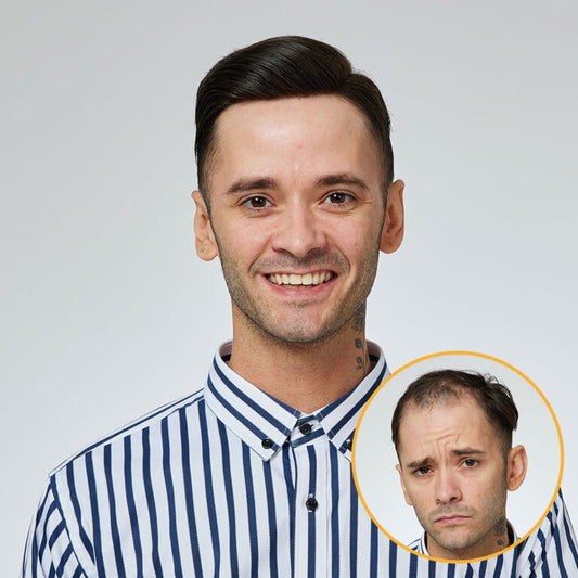 Men’s Lace Hair System – Natural Human Hair Toupee New Australia
