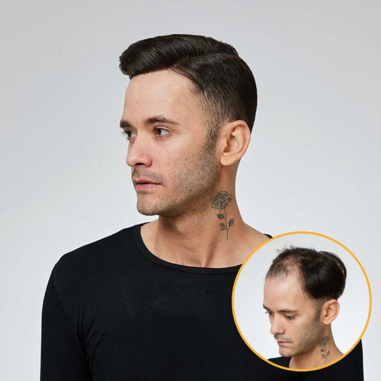 Men’s Thin Skin Hair System – Natural Human Hair Toupee N6